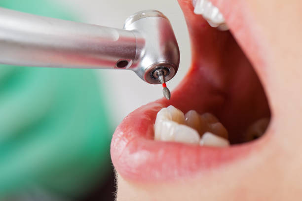 Best Emergency TMJ Treatment in Falmouth, VA